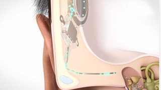 Zo werkt de SOUNDBRIDGE