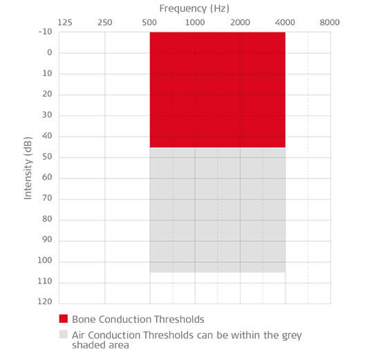 Indications for MED-EL Cochlear Implants, Middle Ear Implants and Bone