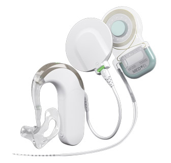 SYNCHRONY EAS Cochlear Implant System