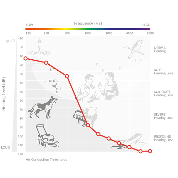 Indications for MEDEL Cochlear Implants, Middle Ear Implants and Bone