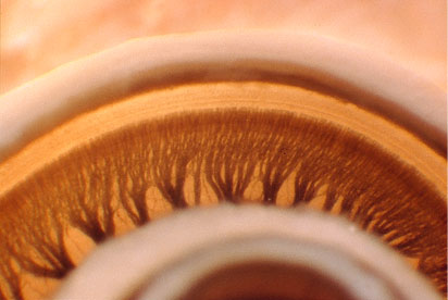 Surgical Techniques for Cochlear Implants